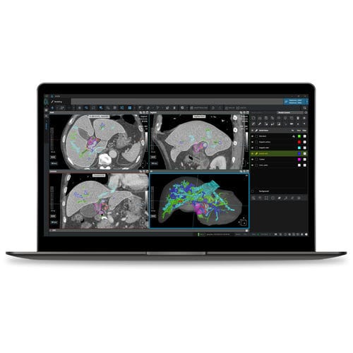 Medizinische Software - Coreline - Computertomographie / Datenverwaltung / Viewer