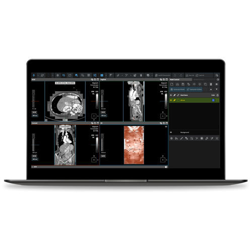 Server-Software - Coreline - medizinisch / Computertomographie / MRT