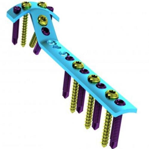 Kompressionsplatte für Tibia - 5709-002-0 series - Ortobio - proximal / mit Verriegelung / Titan