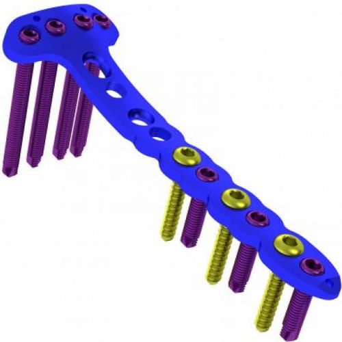 Kompressionsplatte für Tibia - 5713-103 series - Ortobio - medial / mit Verriegelung / Titan