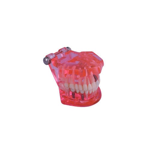 Anatomisches Modell / Zahnfleisch - #A26 - CavoMed / 3D Dental - Gebiss / Wurzelkanal / für Zahnerkrankungen