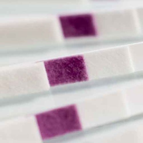 Nierenkrankheiten-Teststreifen - GBR-3409 - Golden BioTechnologies - Adenosinmonophosphat / Urin / Oberflächen