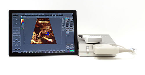 Tragbares Ultraschallgerät - SmartUs  - TELEMED - für Multifunktions-Ultraschall / Schwarz-Weiß / Farbdoppler