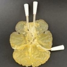 Anatomisches Modell / Circulus arteriosus Willisii - AM20CW  - Samed - für Neurochirurgie / Ausbildung / halbtransparent