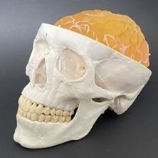 Anatomisches Schädelmodell - AM10BM  - Samed - Schläfen / Gehirn / für Neurochirurgie