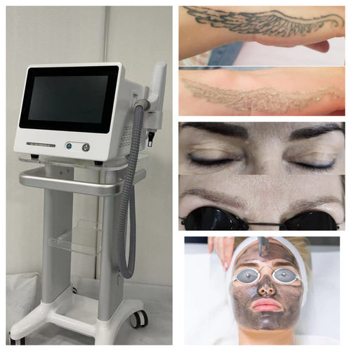 Laser für Hautverjüngung - portable picolaser-6 - Miramhoo Aesthetics - für Pigmentläsionen / zur Tattooentfernung / Nd:YAG