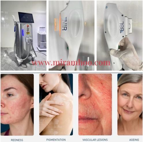 DPL-System / für Pigmentläsionen - Dual Handle NIR DPL BBL Multi-Functional Aesthetic System - Miramhoo Aesthetics - zur Behandlung von Akne / für Hautverjüngung / für Epilation