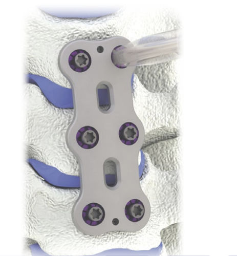 Arthrodeseplatte für Halswirbel - HERO® - HumanTech Dental - 2 Ebenen