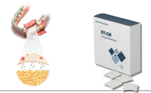 Zahnchirurgie-Matrix - DT-CM - DENTAL TECH S.R.L. - Collagenbeschichtung / resorbierbar