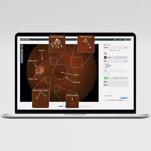 KI-Plattform / für Ophthalmologie - UMI DR - ULMA Medical Technologies - Diagnose / Sensor