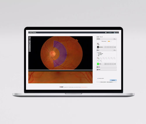 Messmodul für Software - UMI AVR - ULMA Medical Technologies - mit künstlicher Intelligenz / für Ophthalmologie / Netzhaut