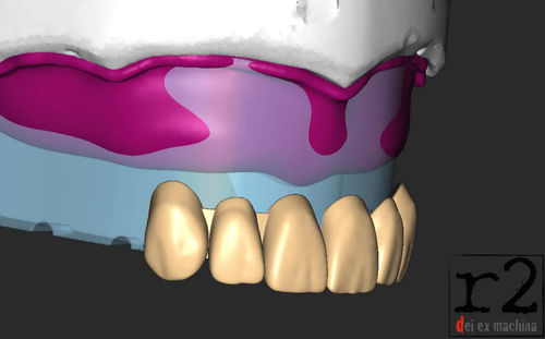 Projektentwicklungssoftware - BiteReg  - Dentona AG - Import / 3D-Druck / Modellierung