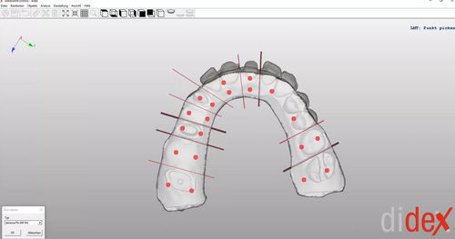 Erfassungssoftware - didex  - Dentona AG - 3D-Druck / Modellierung / Fertigung