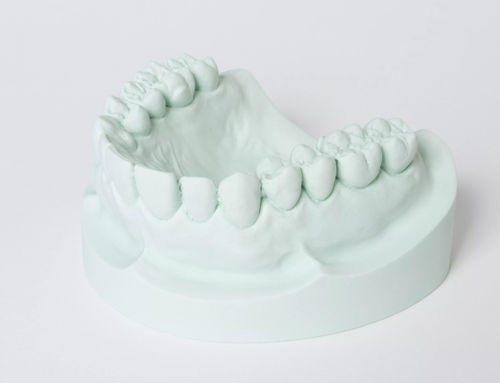 Zahnmedizinisches Material / Gips - hydro-stone® 200 - Dentona AG - Stein / Gieß / zur Modellierung