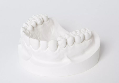Zahnmedizinisches Material / Gips - dento-stone® 220  - Dentona AG - Gieß / zur Herstellung von Zahnprothesen / zur Modellierung