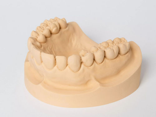Zahnmedizinisches Material / Stein - rapid - Dentona AG - für Abdrucklöffel / zur Herstellung von Zahnprothesen / zur Modellierung