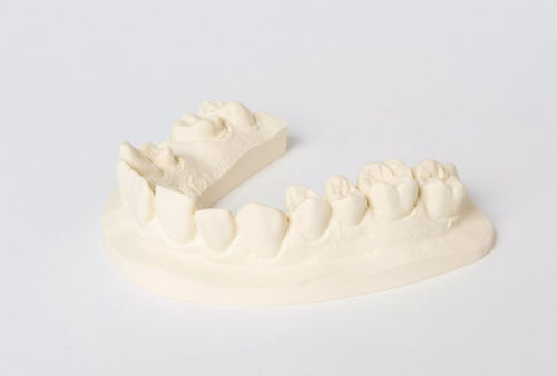 Zahnmedizinisches Material / Stein - No. 1 - Dentona AG - für Dentallabor / zur Modellierung