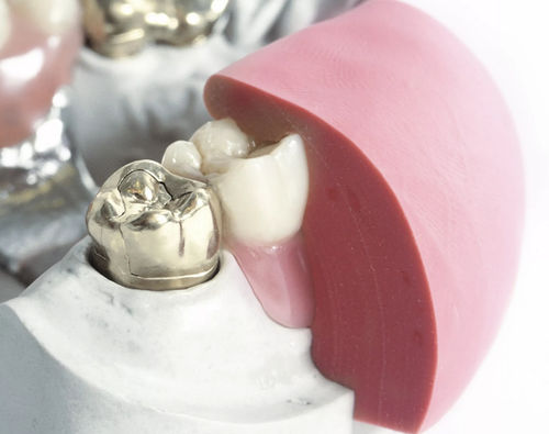 Zahnmedizinisches Material / Silikon - 1:1 gum - Dentona AG - zur Modellierung