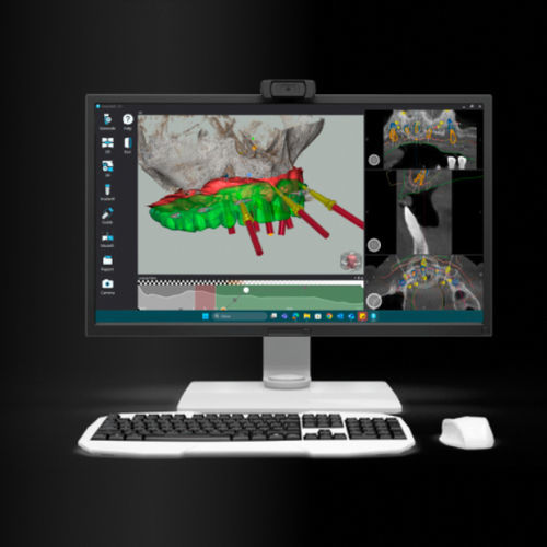 Umform-Software - M3013D - MAG - ADVAN S.r.l. - Planung / Projektentwicklung / medizinisch