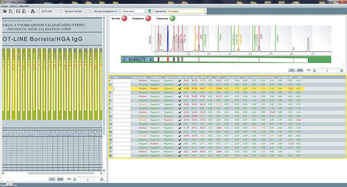 Analysesoftware - SwIm03 - TestLine Clinical Diagnostics - medizinisch / Labor / für Immunblot