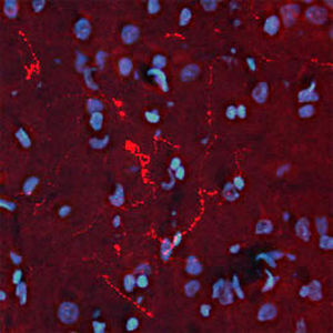 Reagenz für Beta-Endorphin - RA21004 - Neuromics - polyklonaler Antikörper / IgG / für wissenschaftliche Forschung