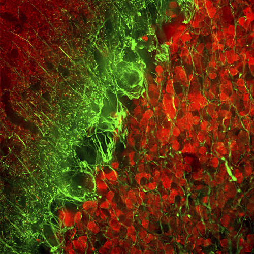 Reagenz für Alpha-Internexin - MO22154 - Neuromics - monoklonaler Antikörper / IgG / für wissenschaftliche Forschung