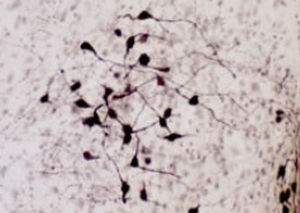 Oxytocin-Reagenz - RA24604 - Neuromics - Antikörper / Serum / Immunohistochimie