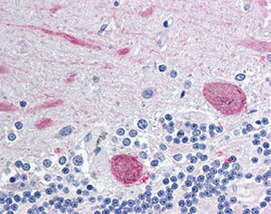 Antikörper - RA30051 - Neuromics - Immunohistochimie / flüssig / Neurotrypsin