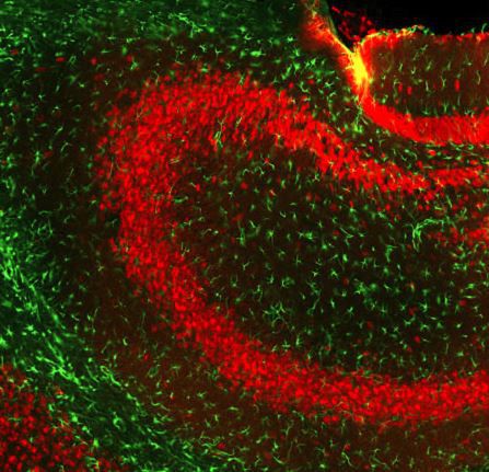 IgG-Reagenz - GT22107 - Neuromics - für wissenschaftliche Forschung / für Western Blot / Immunohistochimie
