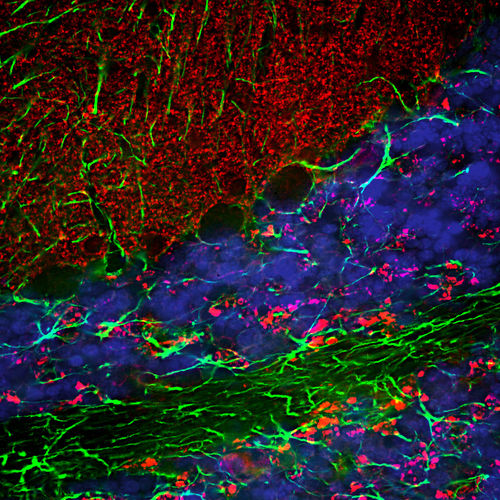 Antikörper - CH22139 - Neuromics - für Western Blot / Immunohistochimie / für Immunofluoreszenz