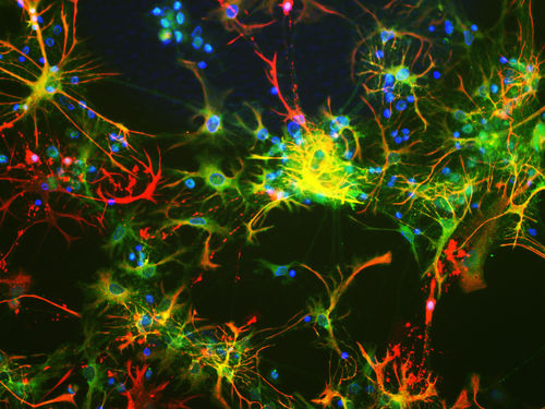 Monoklonaler Antikörper - MO22143 - Neuromics - für wissenschaftliche Forschung / für Western Blot / Immunohistochimie
