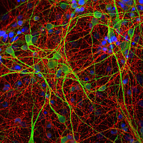 Antikörper - MO22170 - Neuromics - für wissenschaftliche Forschung / für Western Blot / Immunohistochimie