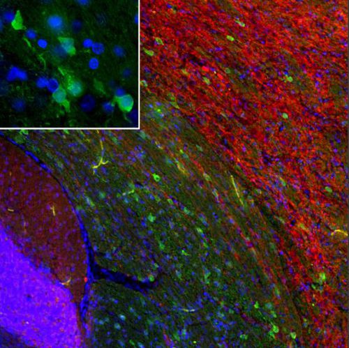 IgG-Reagenz - MO22196 - Neuromics - für Western Blot / für Immunofluoreszenz / für Immunzytochemie
