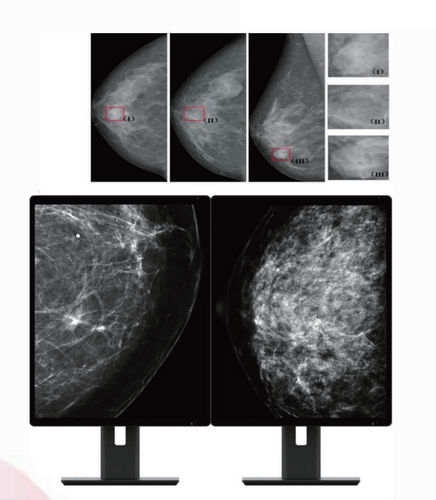 Medizinisch Monitor - MC50A - ZRT Technology - Diagnose / Mammographie / 21,3"
