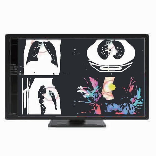 Medizinisch Monitor - MC80A - ZRT Technology - Diagnose / 3840 × 2160 / 31,5"