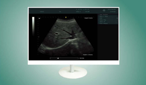 Medizinisch Monitor - MS2210 - ZRT Technology - für Endoskopie / 1920 x 1080 / 21,5"