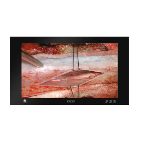Medizinisch Monitor - MD8550T - ZRT Technology - für OP-Bereich / für Endoskopie / 3840 × 2160