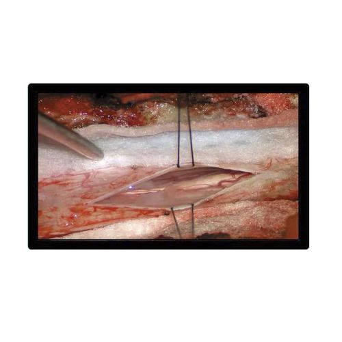 Monitor für OP-Bereich - MS2270P - ZRT Technology - für Endoskopie / 1920 x 1080 / 27"