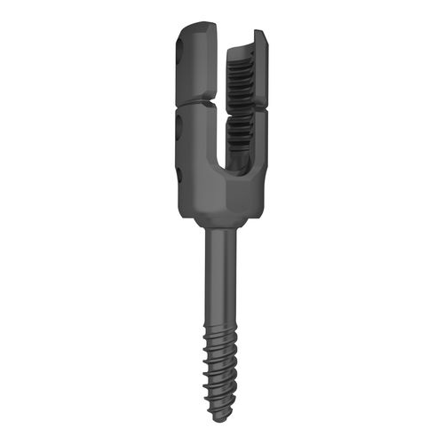 HWS-Pedikelschraube - 323346 series - Boneunion Medical - polyaxial / Titan