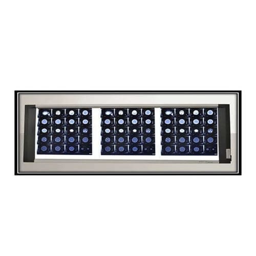 Digitaler Röntgenfilmbetrachter - MV-FV3 - Mediveron - 3 Betrachtungsflächen / LED / mit regelbarer Helligkeit