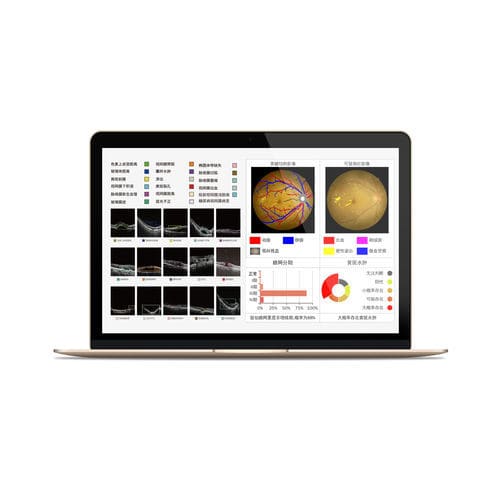 Analysesoftware - MIAS - Big Vision Medical - Diagnose / Sensor / medizinisch