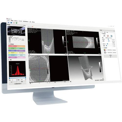 Hilfssoftware - MIPA  - Suzhou Big Vision Medical Technology - für Ophthalmologie