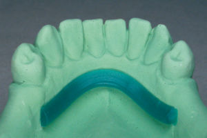 Zahnmedizinisches Material / Wachs - WaxStar - scheftner dental - zur Dentalrestaurierung