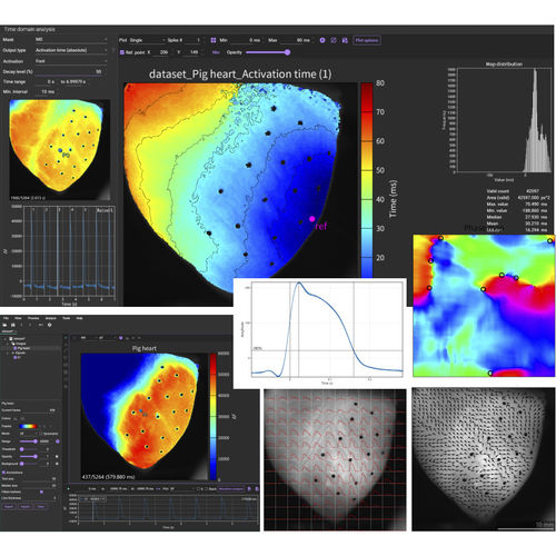 Software für zellulare Bildgebung - BV Workbench  - Brainvision - SciMedia - Herz / Analyse / Datenanalyse