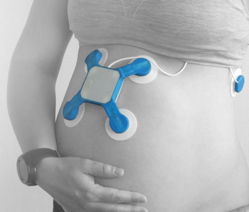 KI-Plattform / für Entbindungsstationen - Baymatob - Monitoring / Diagnose