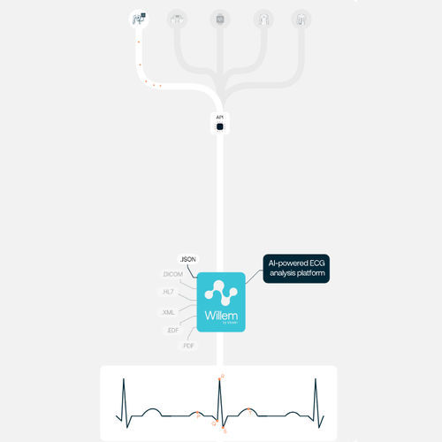 Medizinische KI-Plattform - Willem - Idoven - für Kardiologie / Diagnose / Analyse