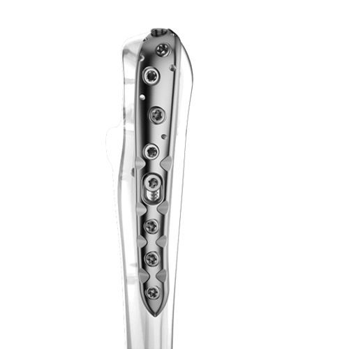 Kompressionsplatte für Ulna - 0316-0100:0101 series - Aplus Biotechnology - für Olekranon / proximal / mit Verriegelung