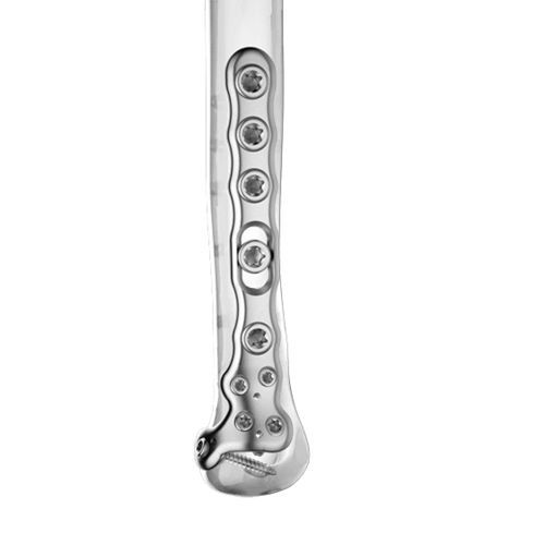Kompressionsplatte für Ulna - 0315-0000:0001 series - Aplus Biotechnology - distal / mit Verriegelung / Titan
