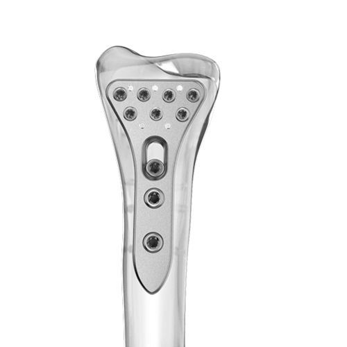 Kompressionsplatte für Radius - 0401 series - Aplus Biotechnology - distal / mit Verriegelung / Titan