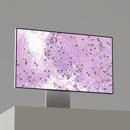 KI-Plattform / zur Brustkrebs-Früherkennung - CleoBreast®  - Primaa - medizinisch / Diagnose / Bildanalyse